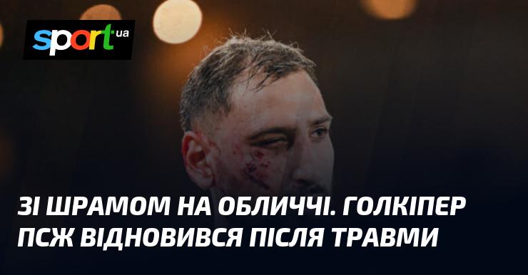 З шрамом на обличчі. Воротар ПСЖ успішно повернувся до гри після травми.